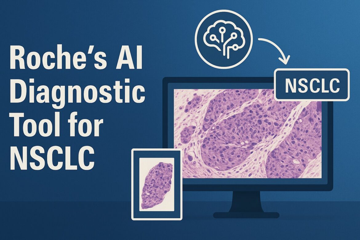Roche’s AI Diagnostic Tool for NSCLC: FDA Breakthrough Device Designation and the Future of Personalized Cancer Care